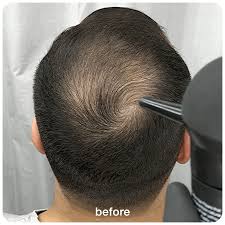B-Fiber Hair Fiber | For Men & Women - Hair Growth Fiber Concealer