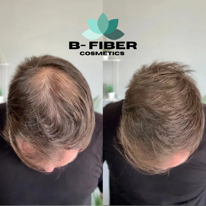 B-Fiber Hair Fiber | For Men & Women - Hair Growth Fiber Concealer