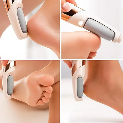 Electric Foot Callus Remover Pedicure - Flawless Pedi Rechargeable Tool File