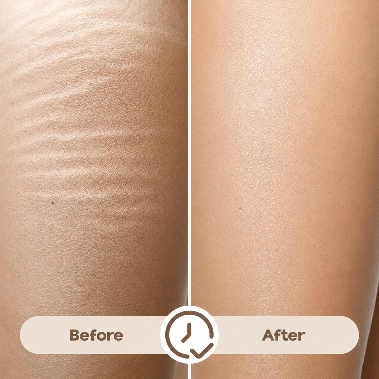 Markless Veil Stretch Mark Serum