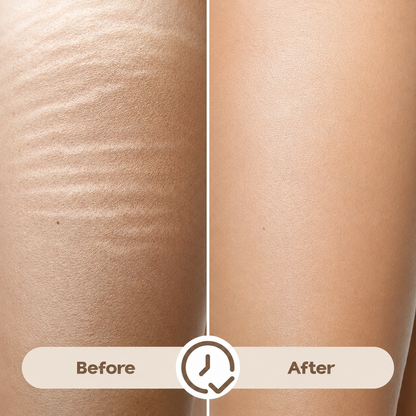 Markless Veil Stretch Mark Serum