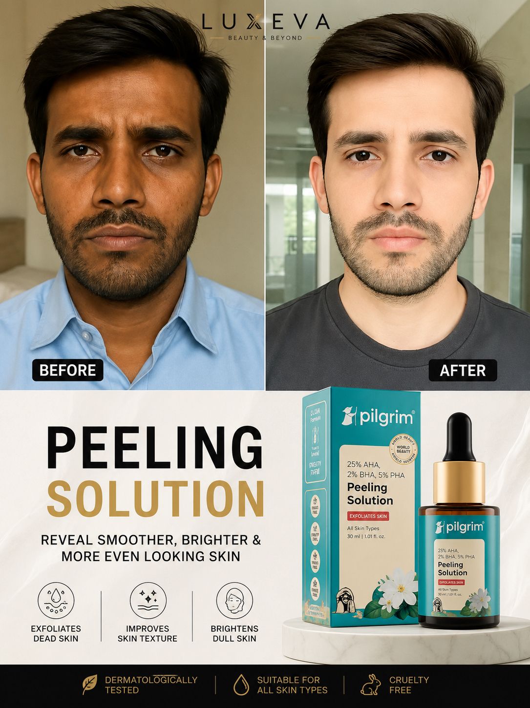 Pakistan No 1 serum - Best peeling solution - Luxeva PK