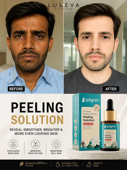 Pakistan No 1 serum - Best peeling solution - Luxeva PK